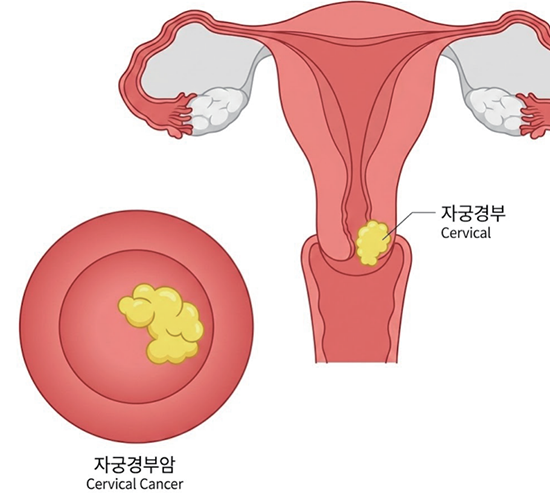 이미지명
