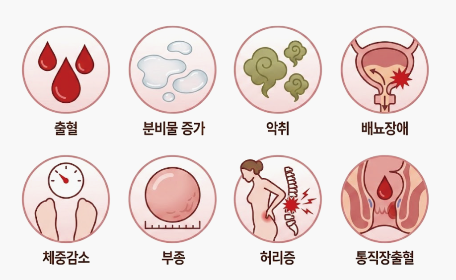 이미지명