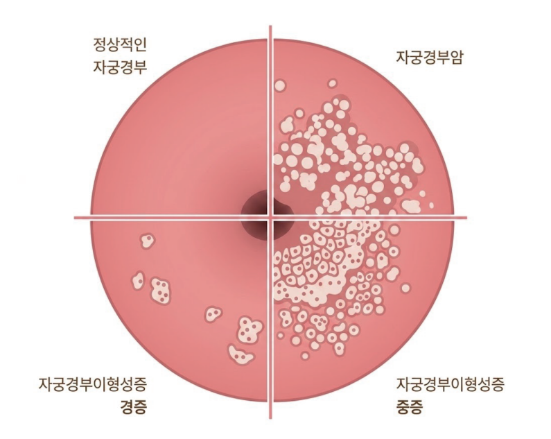 이미지명