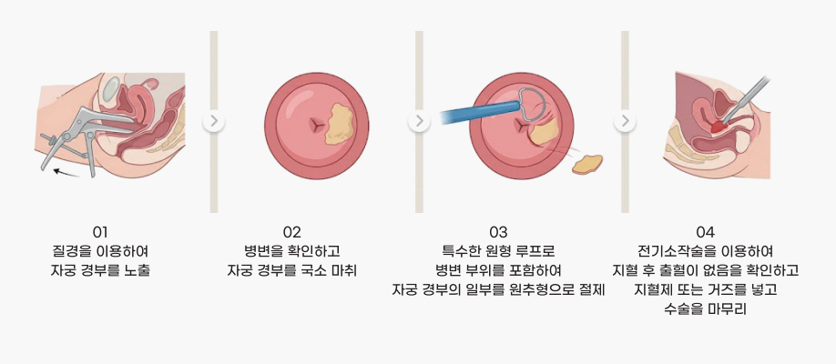 이미지명